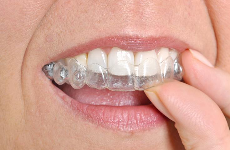 Apitherapie Zähneknirschen